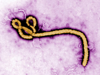 This undated colorized transmission electron micrograph file image made available by the Centers for Disease Control and Prevention (CDC) shows an Ebola virus virion. 