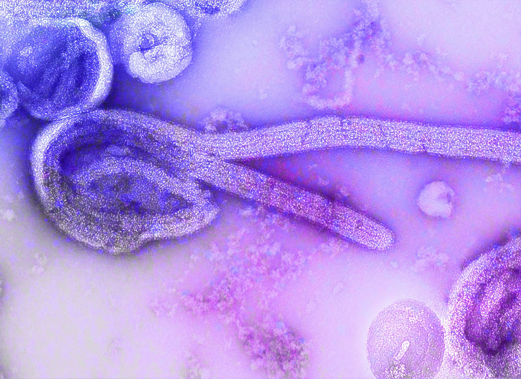 UAE lists six early Ebola warning signs