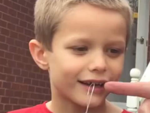 Watch dad pull out son's tooth by hitting golf ball attached to piece of string