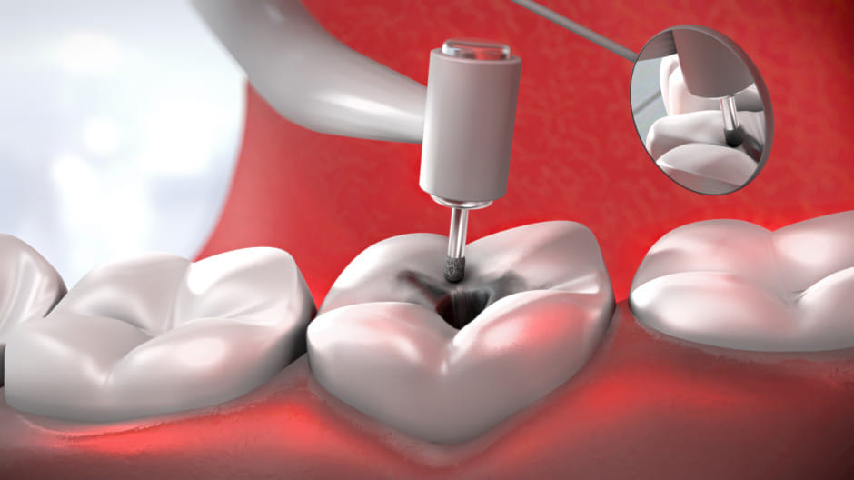 1.1860486-2267650728