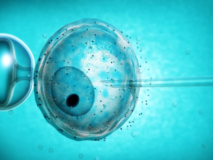 1.2230381-4245670926