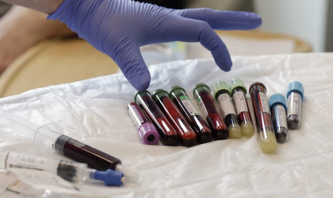 Blood samples taken from a patient receiving a kind of immuno-therapy known as T-cell therapy. T-cells in our body are known as natural "antivirals". They destroy cells infected with viruses and other pathogens. These killer cells are also called “suppressor lymphocytes” because they regulate immune responses by suppressing the function of helper cells so that the immune system is active only when necessary.