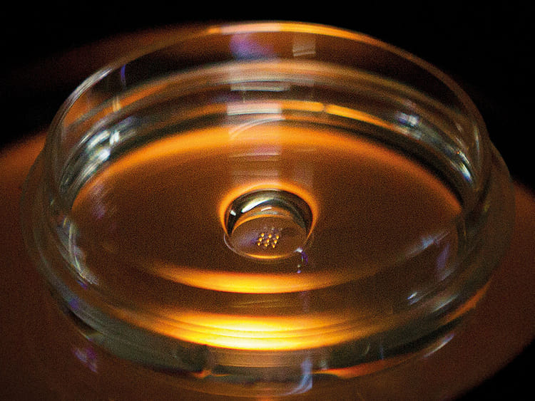 WLD-NEW-GENE-1432-(Read-Only)