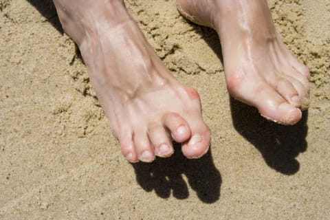 What can you do about a hammertoe?