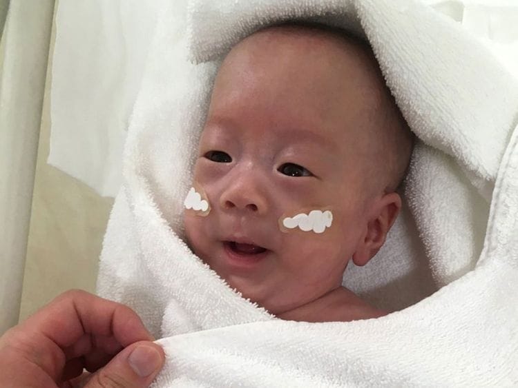 Smallest baby in the world