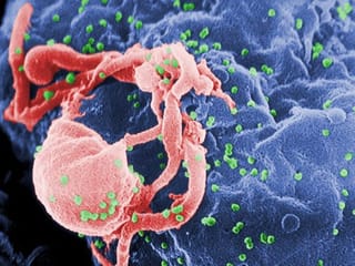 First person: Why a possible HIV cure is not cause for celebration