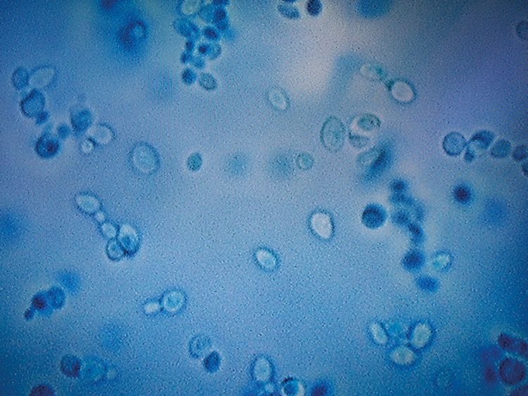 A projection of the C. auris fungus