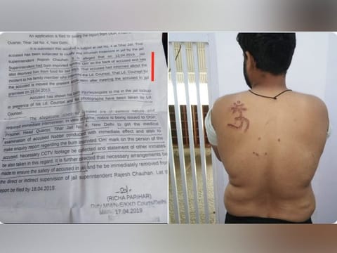 A copy of the court order as well as the burn mark on the prisoner's back