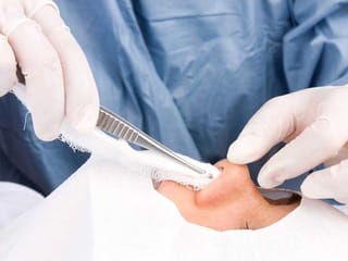 Emirati woman in coma in Dubai: What happened during the surgery?