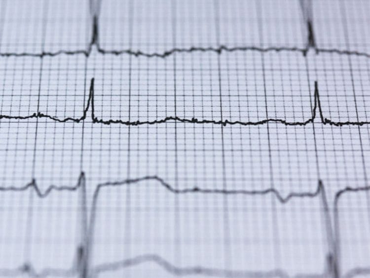 Heart operation 