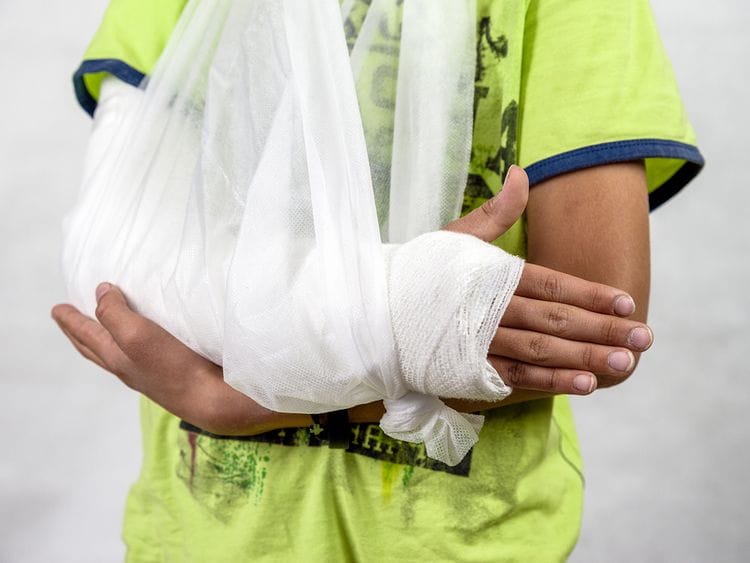 iStock-1028144132 arm cast