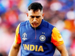 Cricket World Cup: MS Dhoni spat blood while batting against England