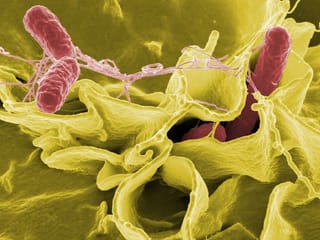 Even ‘healthy’ superfoods can carry salmonella: UAE doctors explain the risks and how to stay safe