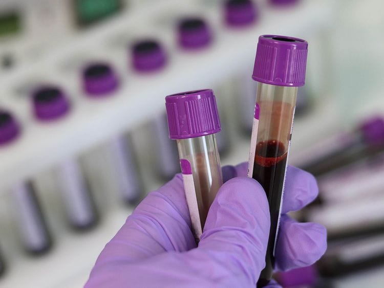 laboratory blood test generic
