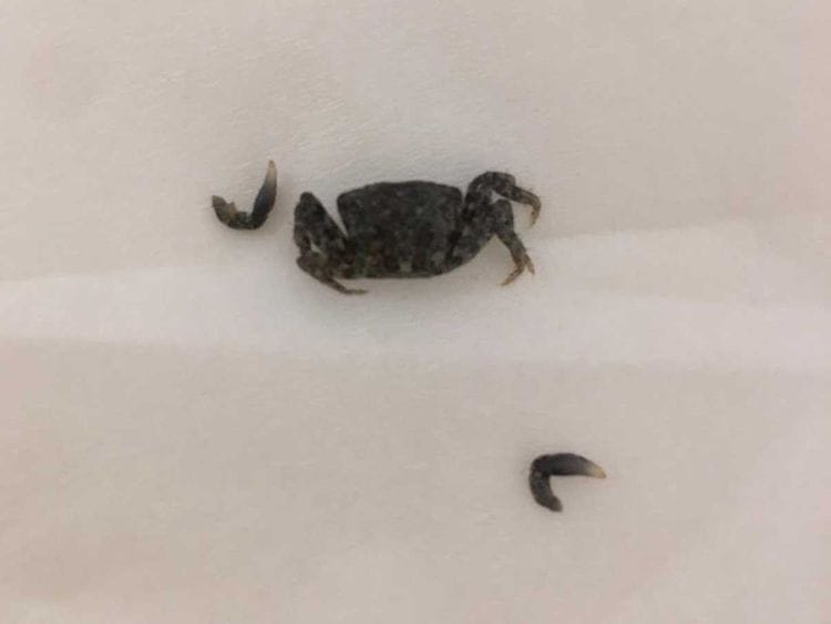 Baby crab in ear