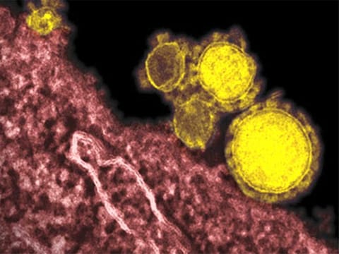 The mysterious new respiratory virus has caused at least 132 deaths.