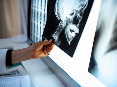  Scientists have made a new discovery of a pair of large salivary glands lurking in the nook where the nasal cavity meets the throat.