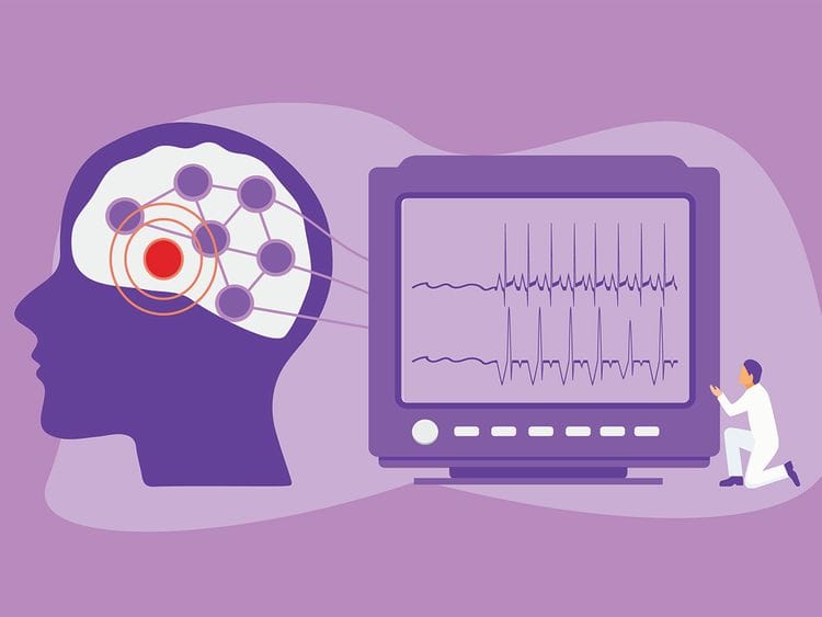 Dubai Health Authority Epilepsy