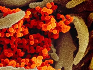 Revealed: WHO releases new data on how coronavirus differs from influenza