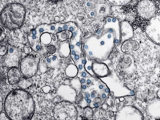 COVID-19: Portraits of a virus