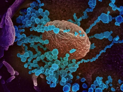 A handout illustration image courtesy of the National Institutes of Health taken with a scanning electron microscope shows SARS-CoV-2 (round blue objects) emerging from the surface of cells cultured in the lab. SARS-CoV-2 is the virus that causes COVID-19.