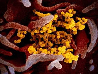 COVID-19: Global deaths from coronavirus pass 280,000