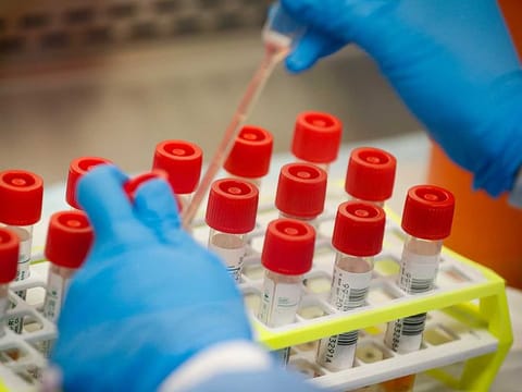 A technician prepares COVID-19 coronavirus patient samples for testing at a laboratory in New York's Long Island. 