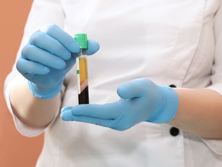 NAT STOCK PLASMA BLOOD-1586614954590