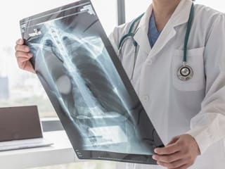 Suffer from asthma? Follow these precautions during COVID-19