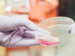 The five kinds of bacteria pregnant women should watch out for