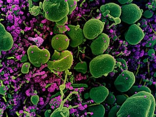 Photos: What COVID-19 looks like under a microscope