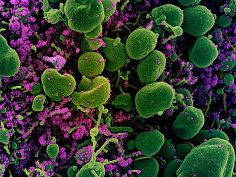 Photos: What COVID-19 looks like under a microscope