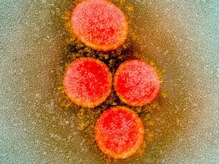 10 points: BA.2.75 sub-variant detected in India, what scientists know — and do not know