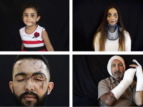 In Pictures: Scars from Beirut blast capture moment of horror