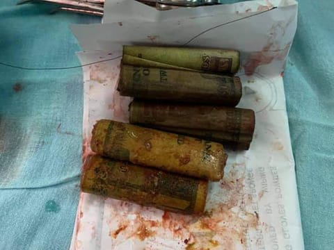 The banknotes extracted from the patient's stomach.