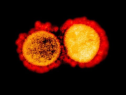 A transmission electron micrograph of SARS-CoV-2 virus particles, isolated from a patient. Some viral mutations can trigger changes in the viral structure, that can confer greater transmissibility and severity. Photo taken at the National Institute of Allergy and Infectious Diseases' Integrated Research Facility in Fort Detrick, Maryland, US.