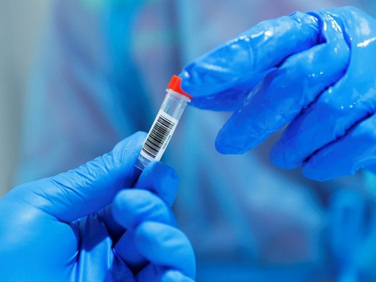 NAT PCR TEST12-1603113310236