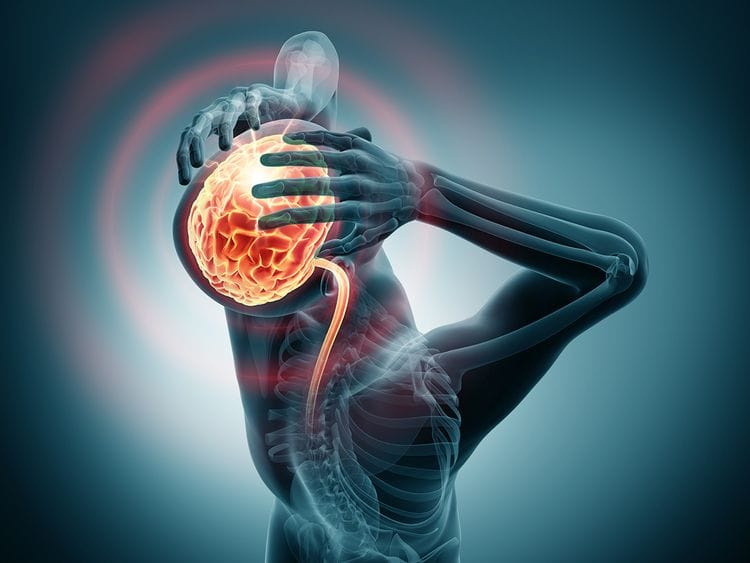 Dubai Health Authority Stroke