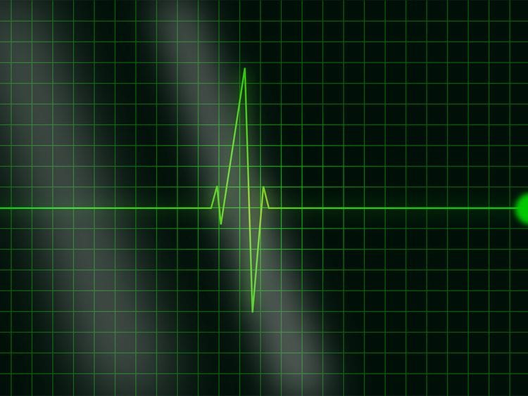 heart rate genric