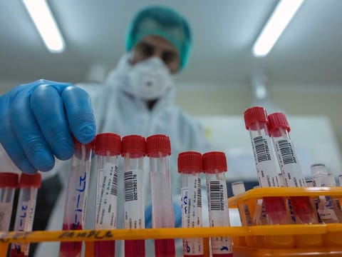 A member of medical staff sorts and prepares viral transport medium (VTM) kits containing swabs for COVID-19 testing in the Bio Safety Lab (BSL) at the Indus Hospital in Karachi, Pakistan.
