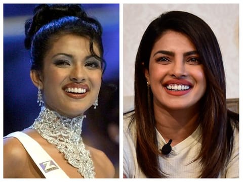 Priyanka Chopra Jonas during the Miss World pageant in 2000 and the actress in 2018 during a visit to Dubai. Chopra Jonas has spoken out about a nose surgery gone wrong in the early years of her career in her memoir, 'Unfinished'.