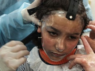Pictures: Gaza girl dons 3D-printed mask to heal burnt face