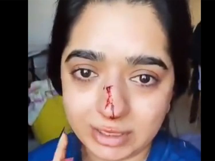 Hitesha Chandranee 