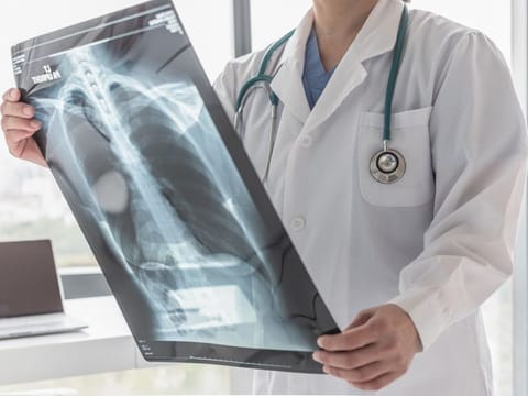 According to the National Centre for Biotechnical Information (NCBI) and the National Institute (NIH), nearly 40 per cent of the COVID-19 patients get serious lung infections. Of these, nearly 20 per cent patients end up with lung fibrosis where damage is permanent.