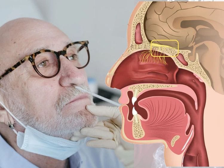 Nasal olfactory