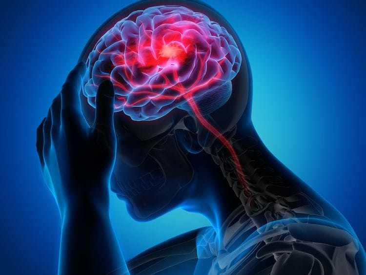 STROKE 