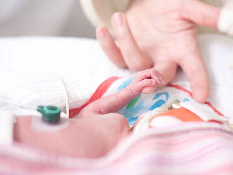 Preterm baby