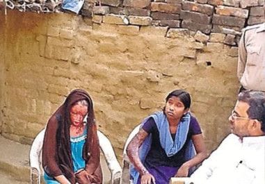 Acid attacks victims from Patna district in Bihar. One of them (left) later died.