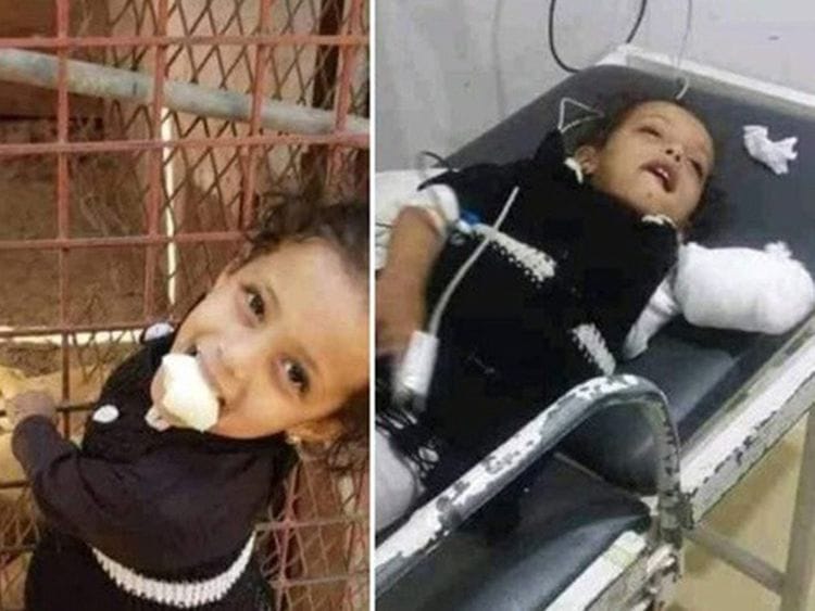 The girl at the cage (left) and later at the hospital.