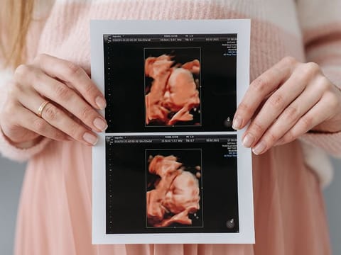 It's always nice to know what to expect when you are expecting. | Photo for illustrative purposes only.